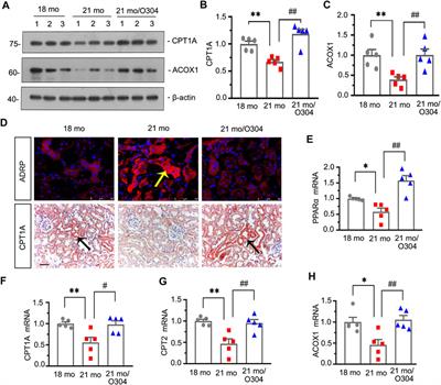 AMPK Activator O304 Protects Against Kidney Aging Through Promoting Energy Metabolism and Autophagy